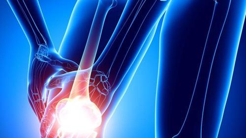 风湿病|有风湿的，少碰这些食物少做它，或许能减少诱发风湿