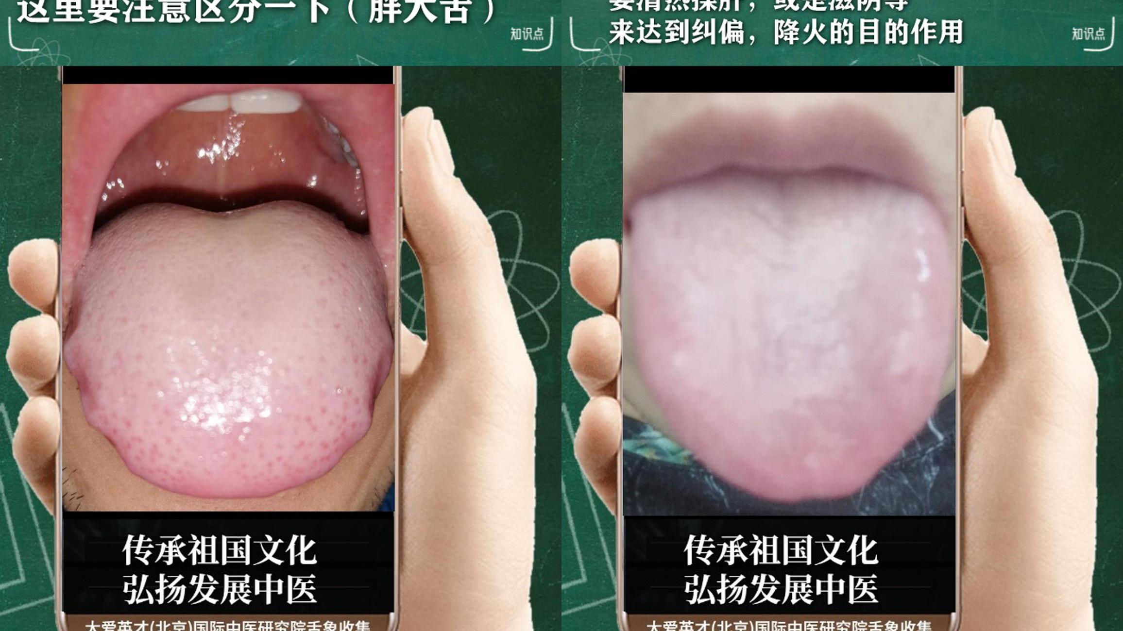 内分泌失调|中医实例：面色黄暗，内分泌失调，鼻子不通，肝气郁滞