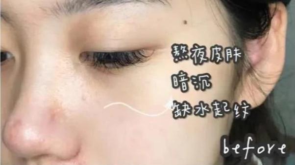 护肤品|冬季护肤品不用买太贵，身边这几种老国货，补水保湿真的很不错