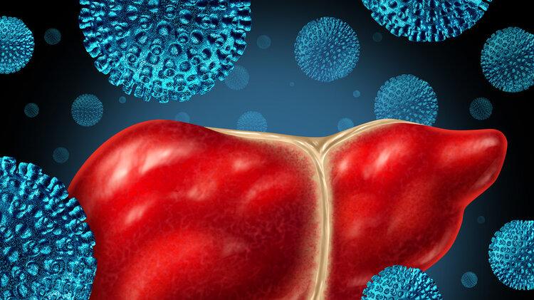 肝癌|全球一半肝癌在中国，提醒：家中的2种食物，尽早撤下餐桌