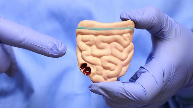 鼻咽癌|排便时出现这4种表现，可能是肠癌的征兆，别忽视了