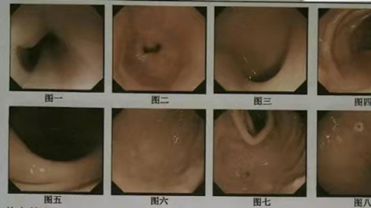 长寿|体重和寿命有关？研究发现：微胖的老人或许更长寿，你达标了吗