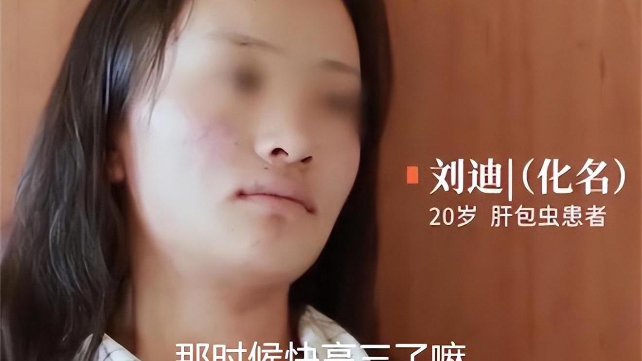 老中医|?19年一藏族少女患“虫癌”，医生开刀取出2斤虫子，最后结果如何