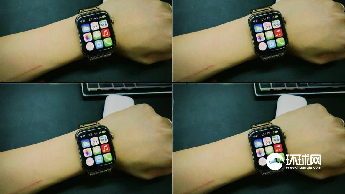 Apple Watch|报告：Apple Watch可能要到2024年才能配备血压监测功能