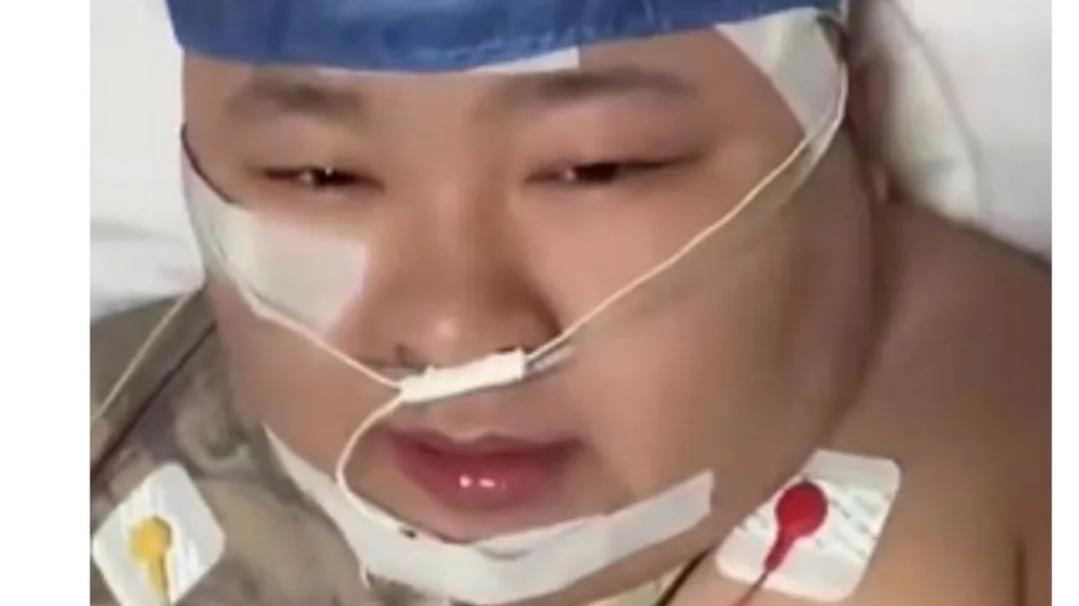 苦瓜|网红胖猴结束了，体重600斤危及健康，教练表示救不了