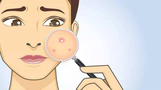 儿童去黑头用什么洗面奶好