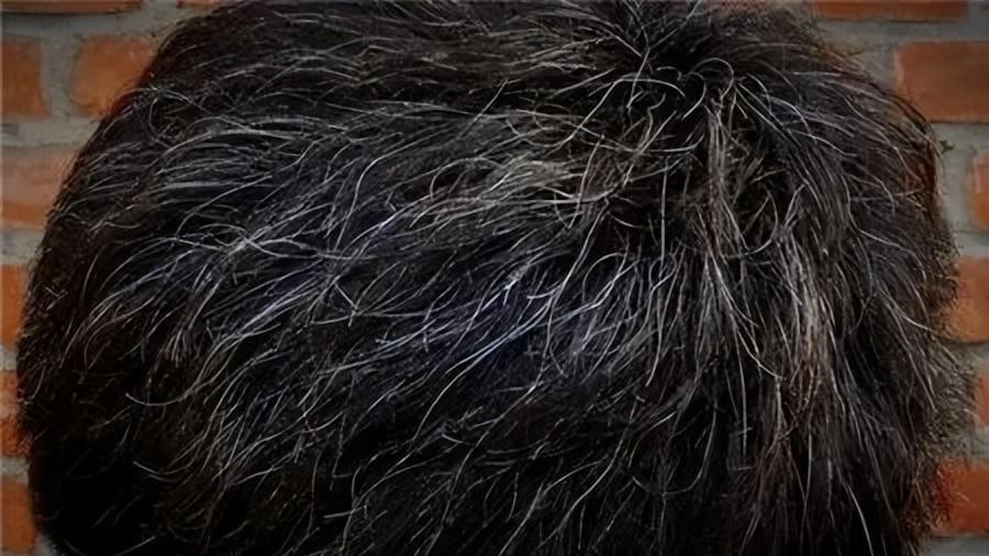 孩子长了白头发，别慌！可能是你没给吃对