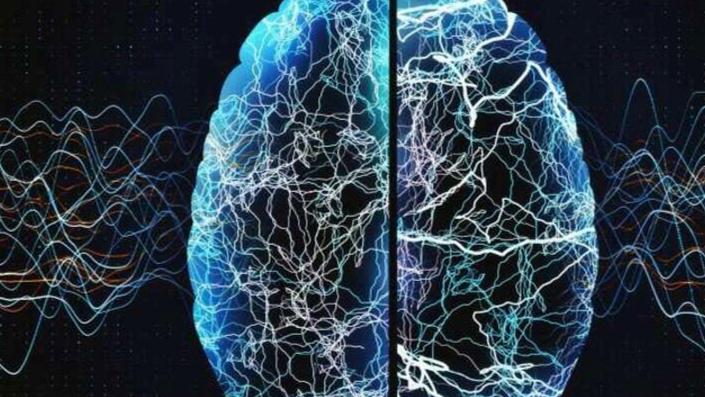 淋巴结|老年痴呆可防可控！做好6件事，可降低发病率