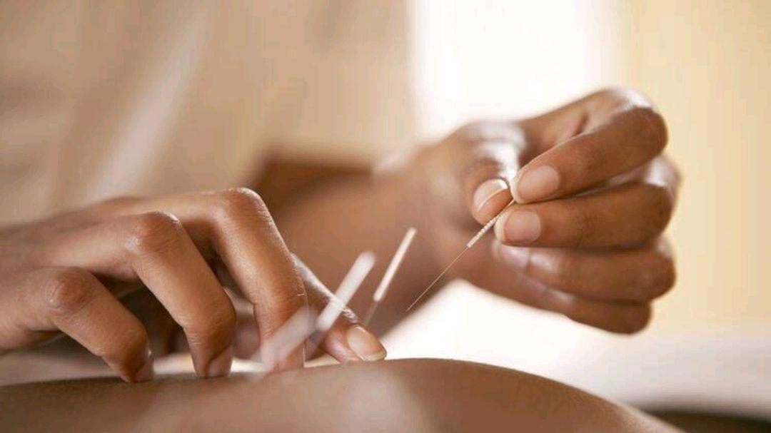 针灸大师尹真，以实践为基础形成独特针灸方法，启迪后学少走弯路