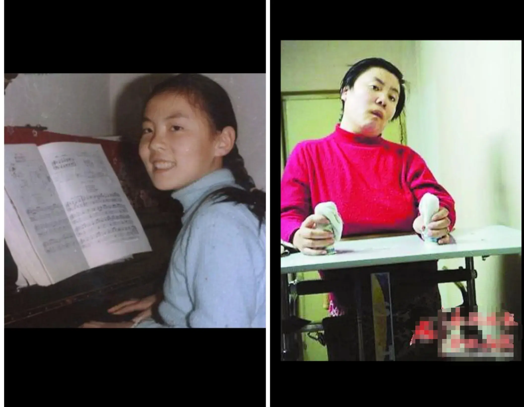 1995年朱令第二次被投毒后，抢救真实照片！瘫痪在床痛到面目狰狞