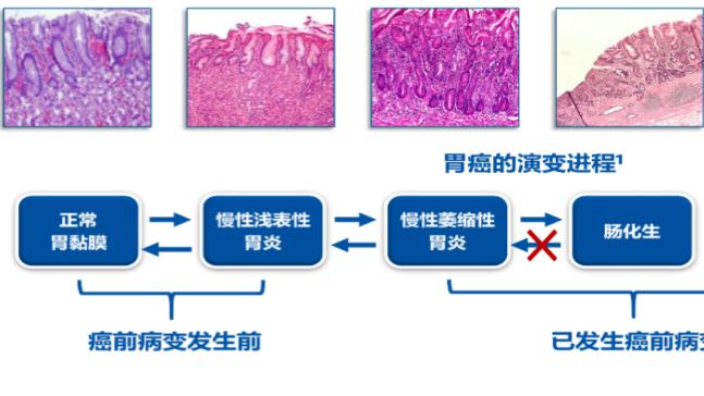 55-65岁是“养命黄金期”，要是查出这5种小病，要早治疗早救命了