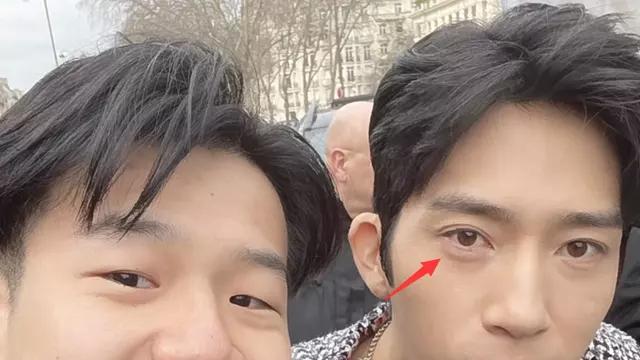 井柏然被质疑整容失败，割双眼皮眼睛一大一小，皮肤松弛人很憔悴