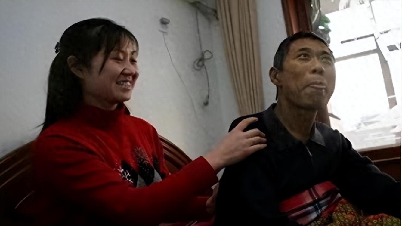 儿媳捐肝脏给公公，没了半条命，却遭丈夫嫌弃：她自愿的，能怪谁