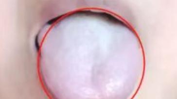 教你分辩你是否也出现了肾阳虚？自测顺便给自己打个分吧