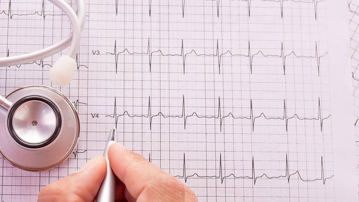 心率总在80以上，心脏会不会太累了，如何控制心率呢？