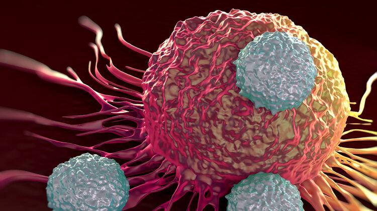 当一位癌症晚期病人遭遇新冠后，高烧可以“烫”死癌细胞吗？