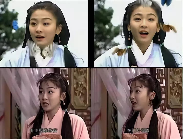 她因拍戏被人打成脑震荡，一运动就想吐，当事人下跪依旧无法释怀