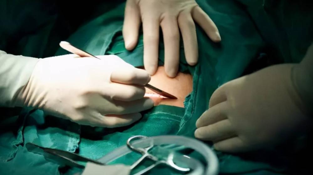 剖腹产和顺产哪一个更好一点？这些后遗症大家一定要知道！