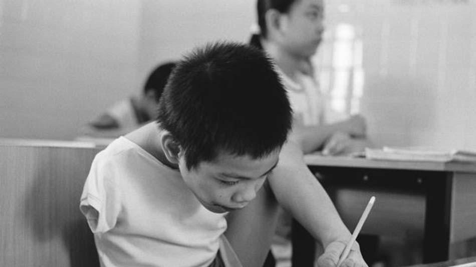 橙剂事件回顾：毒性是砒霜的900倍，越南受害者惨不忍睹