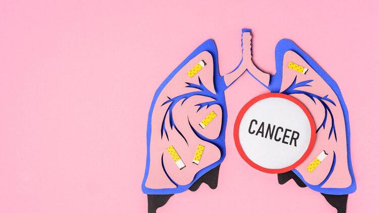 肺癌|阴性评价准确率达100%！“复旦肿瘤”率先提出肺癌淋巴结清扫策略