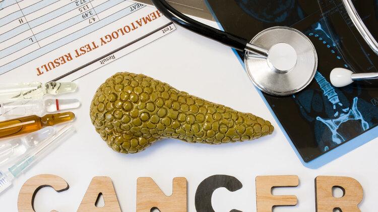 胰腺癌|胰腺癌：从确诊到死亡仅仅两个月！4个症状，可能都是它的脚步声