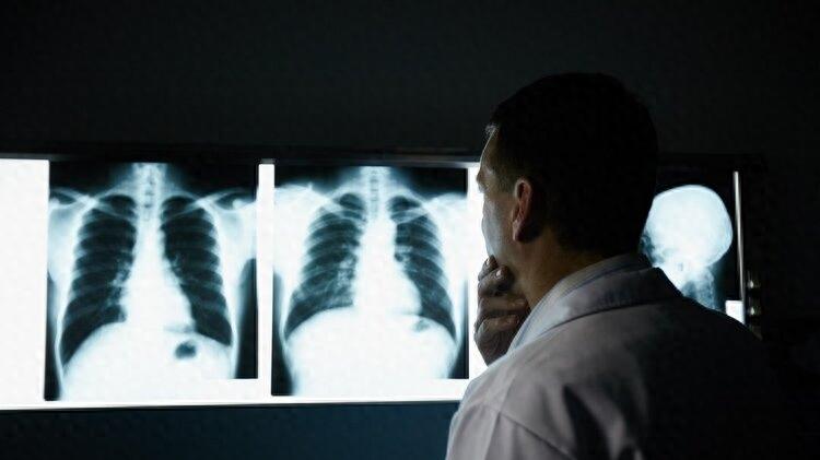 身体有癌，肩膀先知？提醒：这3种肩痛可能是癌症征兆，需警惕