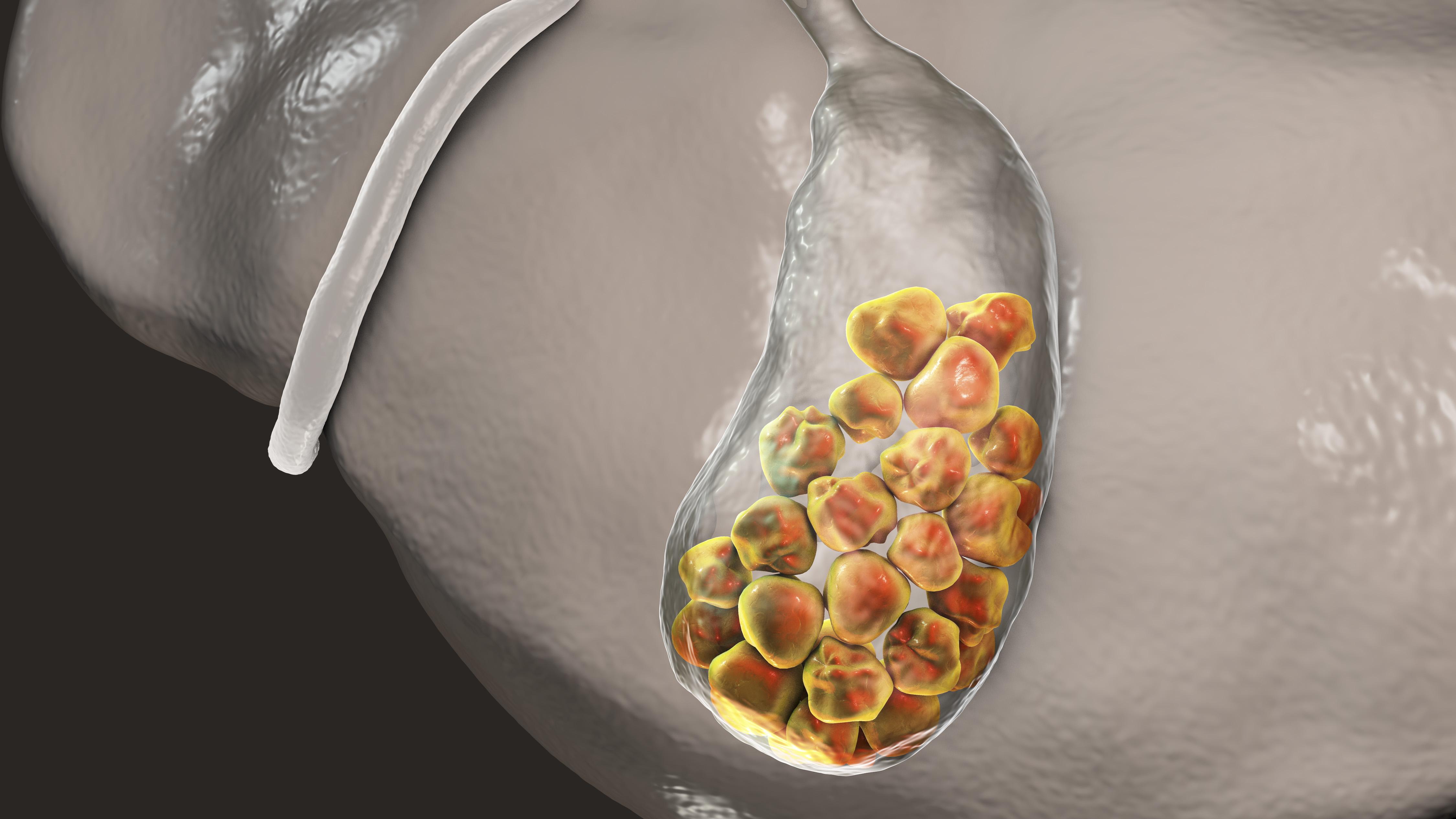 膀胱癌|小小的胆囊，有什么作用？