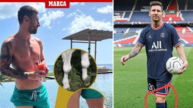 罕见！梅西膝盖鼓起肉球，跟山羊腿一样，球王专属，难怪拉不倒