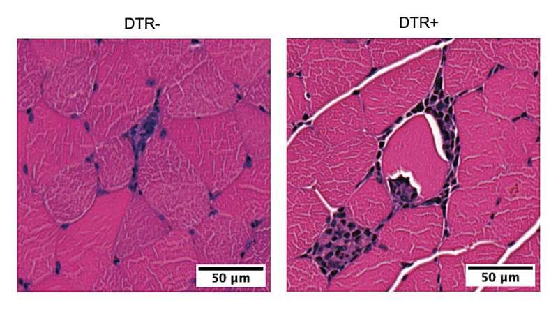 运动立大功！哈佛新研究：运动可激活T细胞，增强免疫力