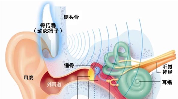 明明戴了助听器，为什么还是听不清楚？