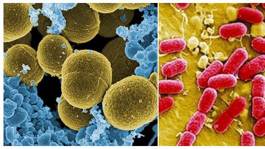 服装定制干货——一分钟了解什么是抗菌面料