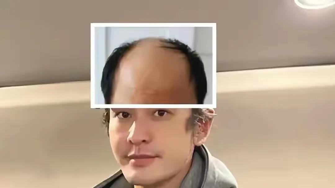 黄晓明频犯太岁，与网友合影都被调侃遮掩秃顶，还有人说他像郭达