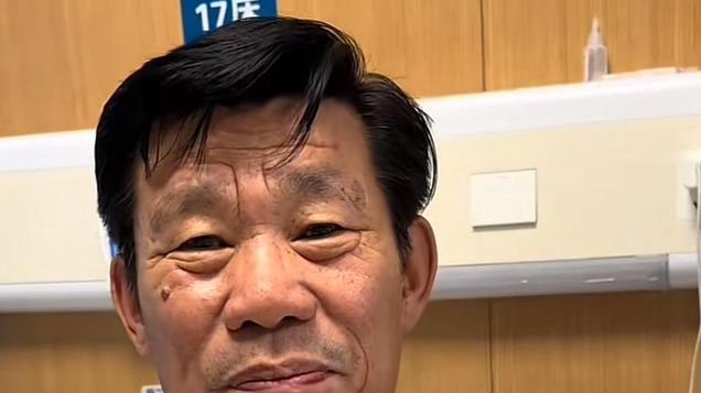 亮剑：演员杨清文确诊癌症，发文透露细节，满口黄牙被吐槽