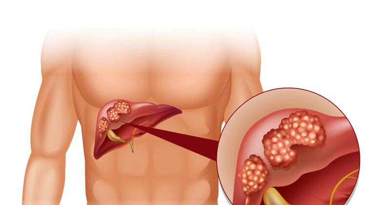 实话实说：喝酒后出现6个现象，或说明你不适合喝酒，趁早戒酒吧