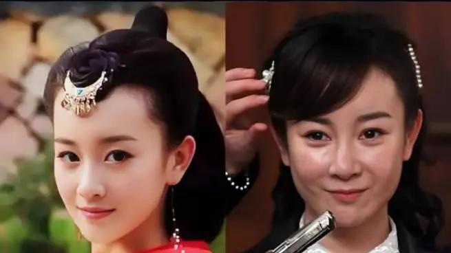 微整的后遗症，37岁的王子文脸垮了！网友：医美后遗症太可怕了~