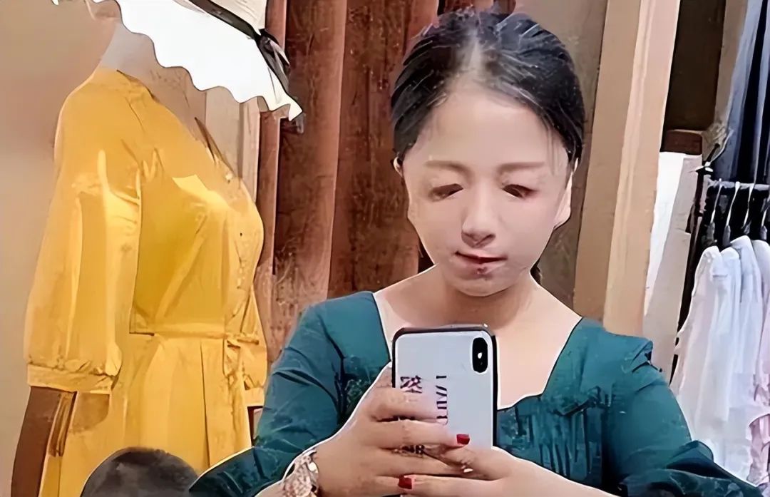 河南一“鸟脸”女子不听劝，执意生二胎，看到孩子长相后，全家都懊悔不已