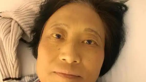 眼睛是肝病放大镜？医生提醒：眼部若有这2个表现，赶快去检查