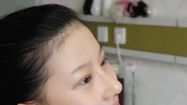 19岁少女执意整成刘亦菲，连名字也高仿，8年后却过上另一种人生