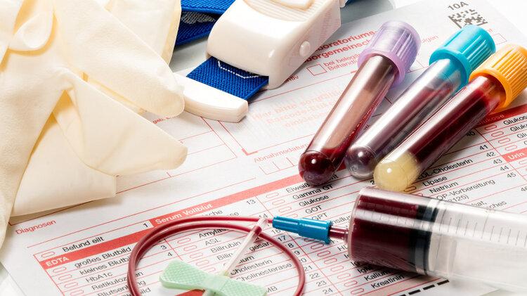 “甘油三酯大户”被揪出，提醒：55岁后，这4 类食物尽早忌口