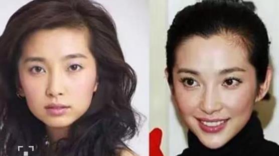 51岁李冰冰衰老明显，取出假体融掉了玻尿酸，选择自然老去