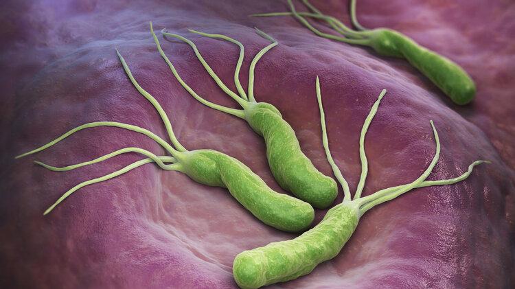 柳叶刀：幽门螺杆菌是中国胃癌最大的祸根，牢记3个办法彻底根除