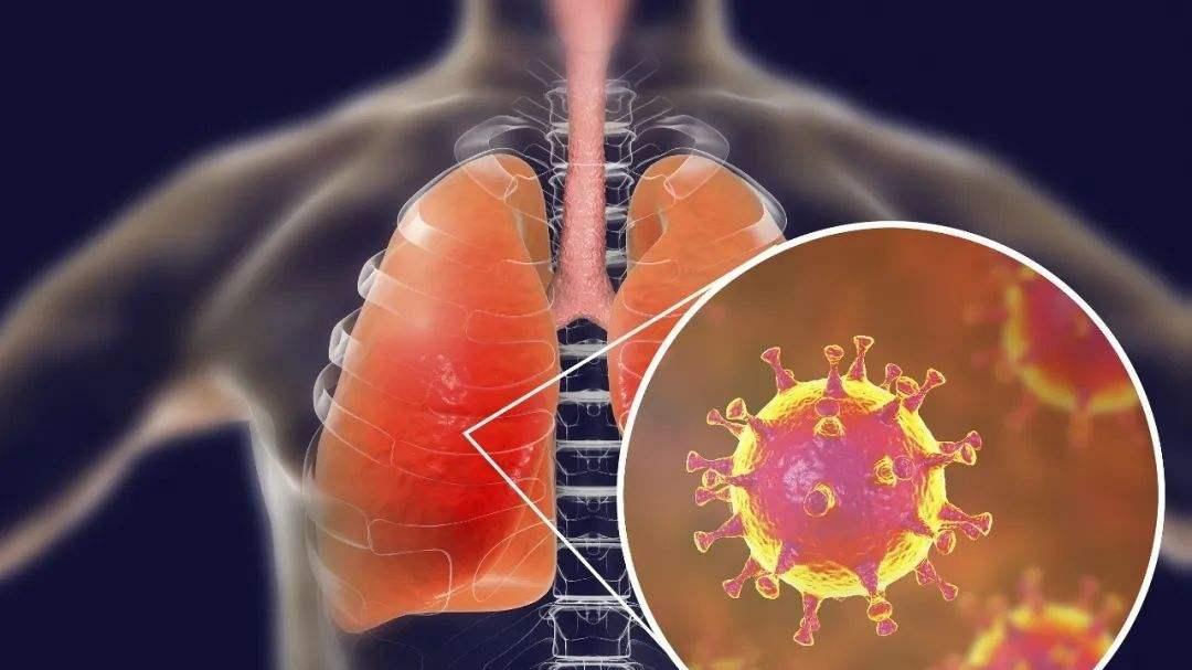 不要将肺炎错当做上呼吸道感染，注意4种表现，别再错误解决