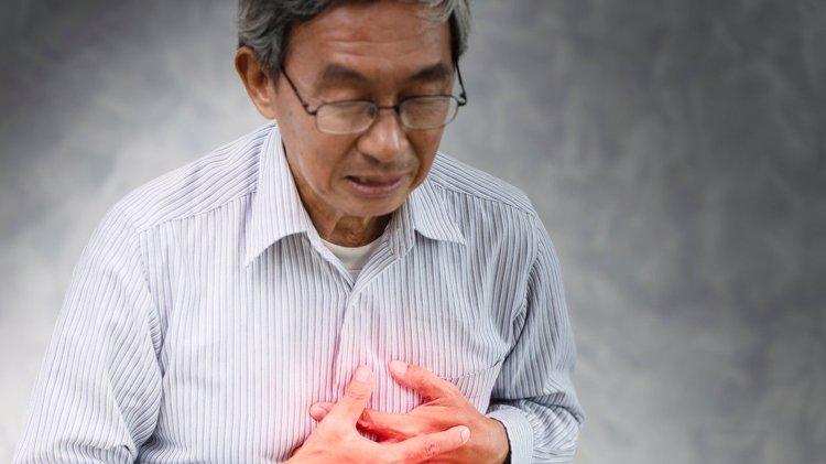 一周至少七次，61岁男子突发脑梗！医生气恼：这么大年纪不懂节制