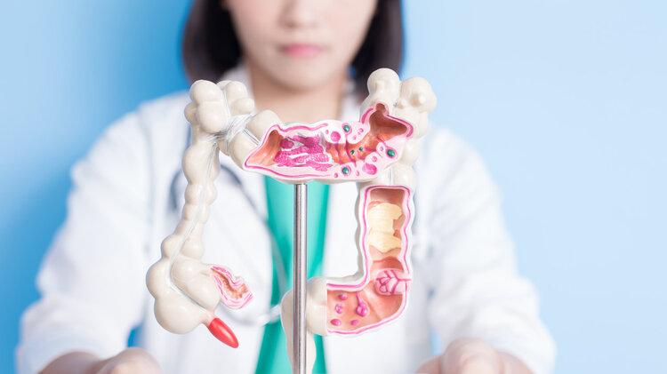 “肠癌大户”被揪出，是烟酒的十倍，医生：再不忌口，肠或烂如泥