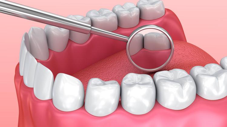 掉牙和寿命有关？60岁后，牙齿剩多少颗才正常？看看你达标了没