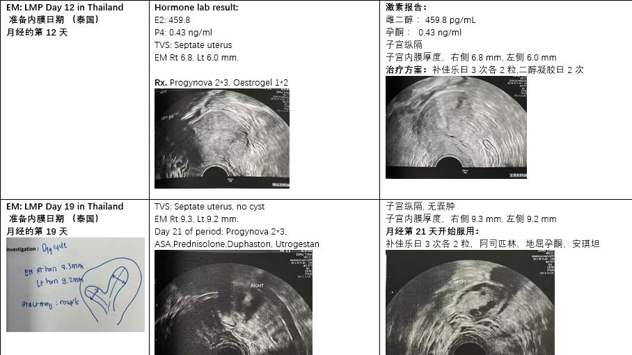 真实自述：30岁原发性不孕成功上岸！伴有子宫纵膈