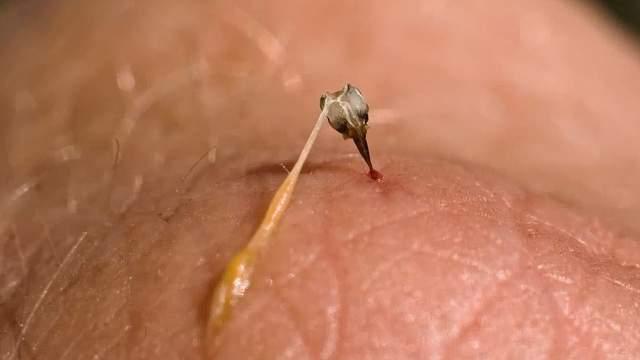 既然蜇人后一定会死掉，为什么蜜蜂还要进化出蜇人？