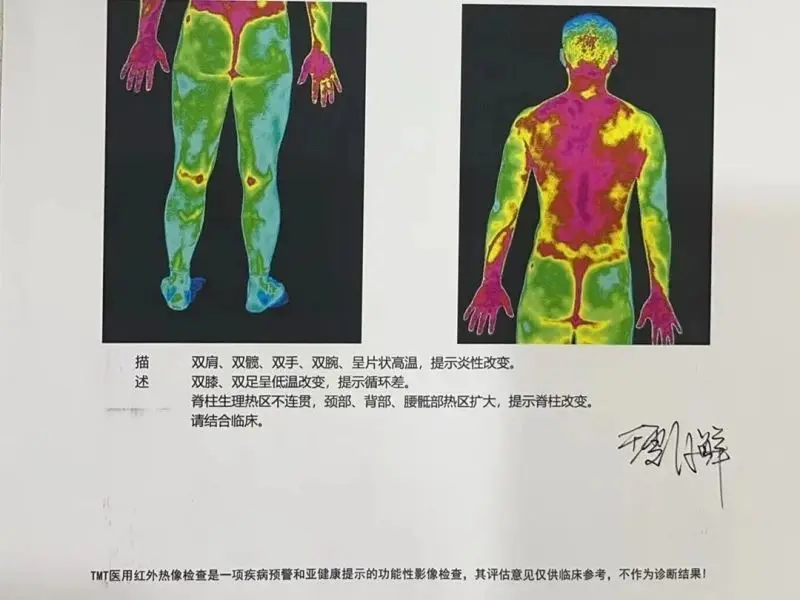 强直性脊柱炎为何容易反复？