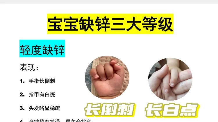 宝宝缺锌怎么办？三大缺锌等级全攻略！