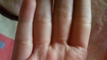 事业线长从月丘出发，在事业上易得贵人帮助。